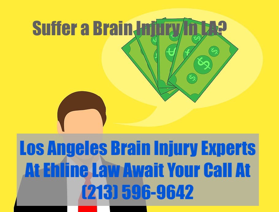 brain injury lawyers