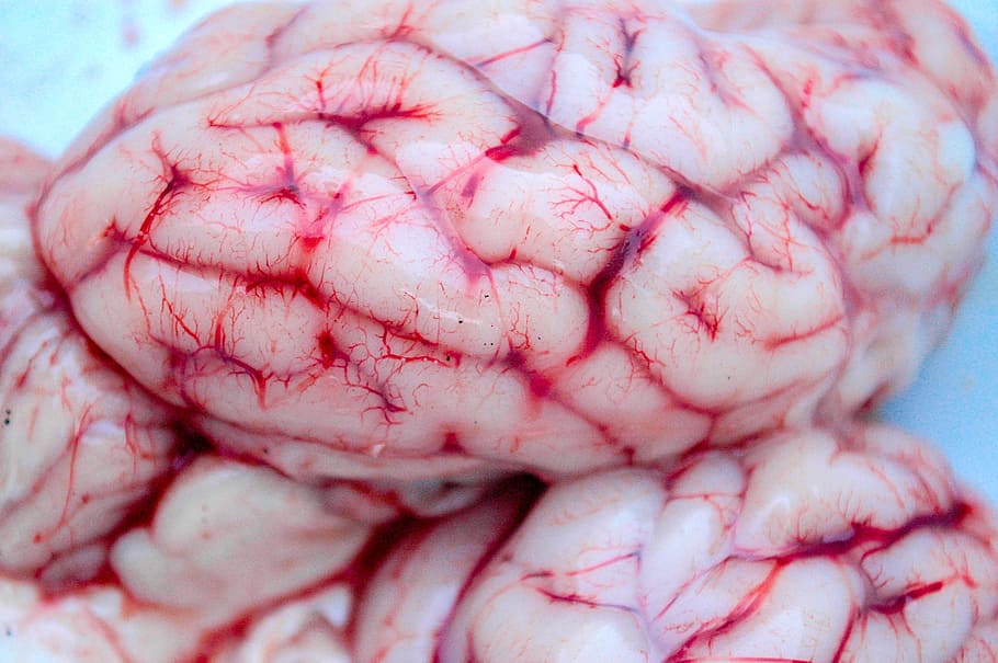 Brain anatomy image for accident victims. Creating the Intimacy Equation | Brainwaves and Emotional Health