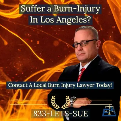 Dust Burn Injuries Law Firm in Los Angeles