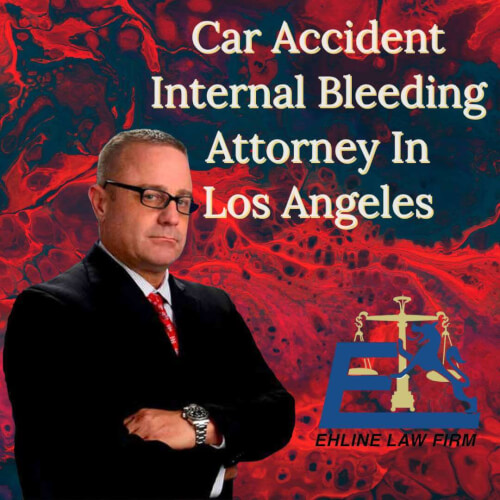 Car Accident Internal Bleeding Attorney In Los Angeles