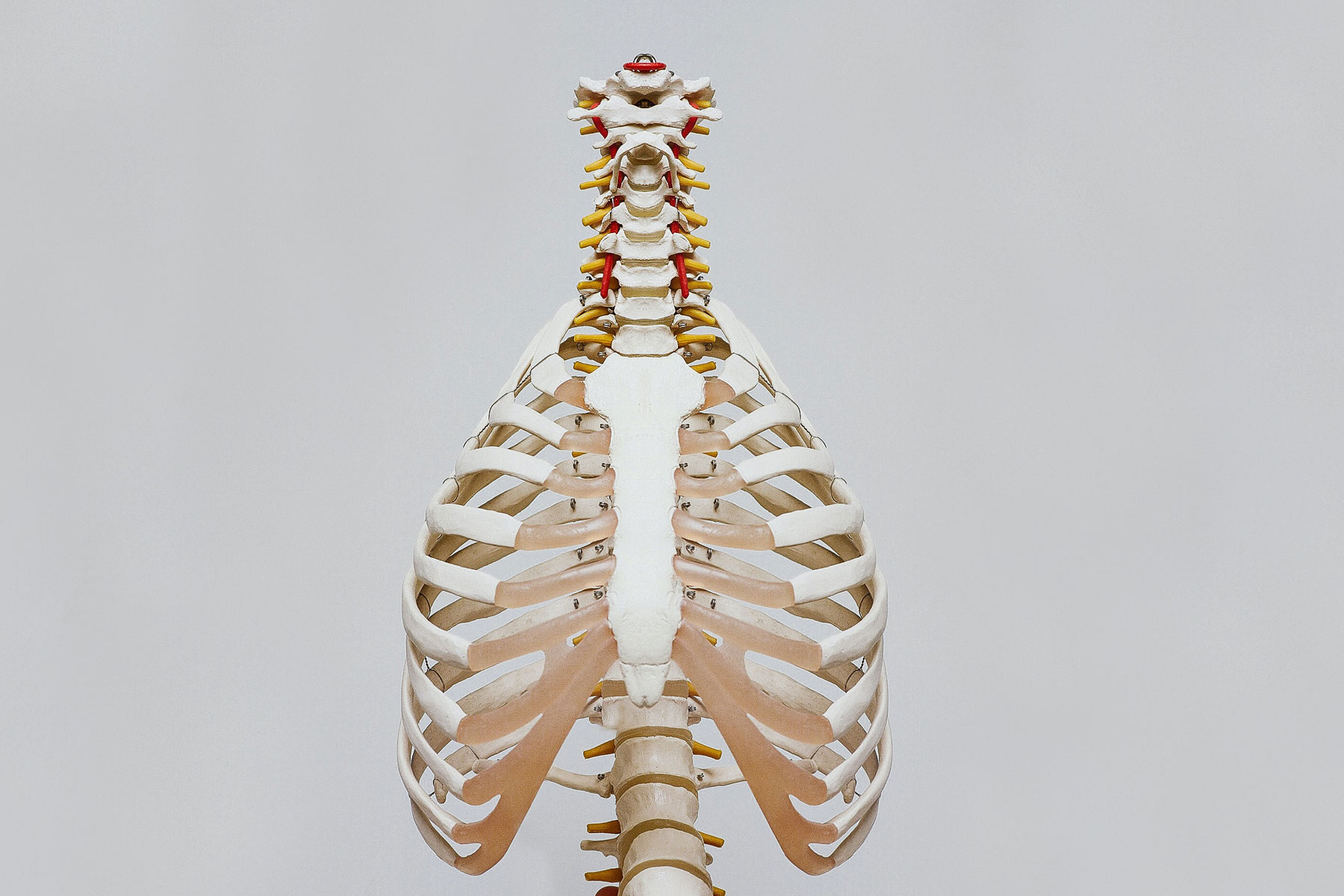 Los Angeles Spinal Cord Damage Attorneys