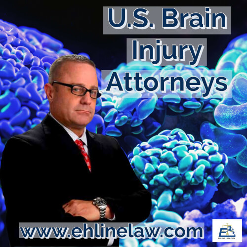 Brain Injury Lawyer USA